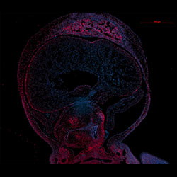 RBP1 gene expression in a CS16 human embryonic heart